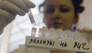 Лабораторные исследования на ВИЧ-инфекцию