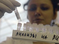 Лабораторные исследования на ВИЧ-инфекцию
